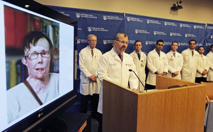 2013, ο δρ Μπ.Πόμαχακ με την ομάδα των χειρουργών που έκαναν την μεταμόσχευση στη Κάρμεν. 