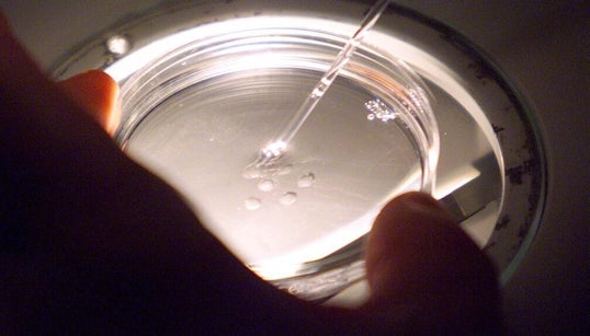 L’autoconservation des ovocytes adoptée par l’Assemblée