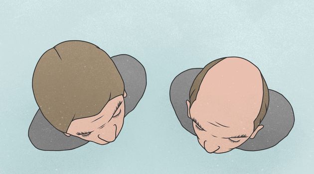 The Bald Facts: Air Pollution Could Be Causing Your Hair Loss