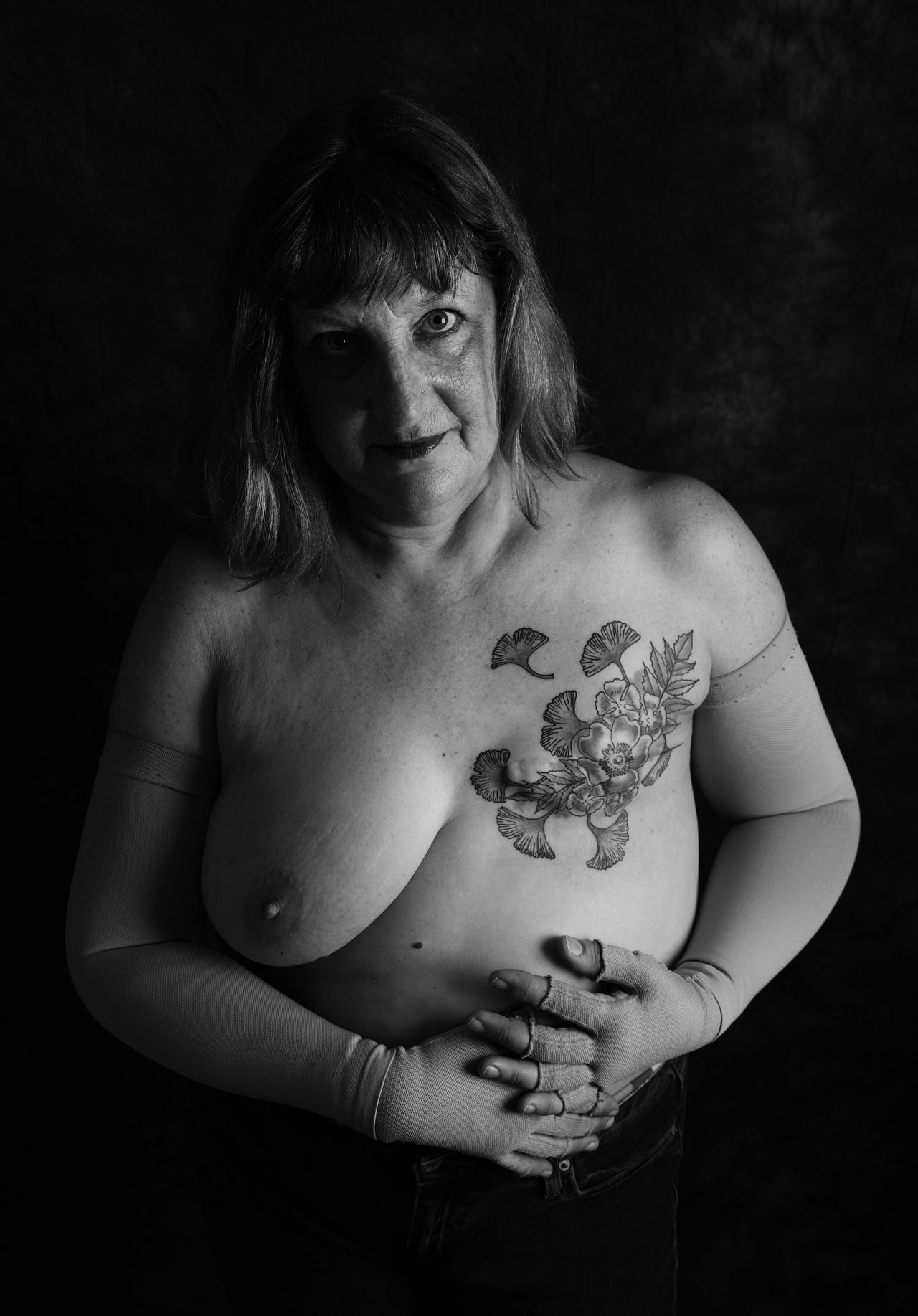 Η 59 ετών Άλισον Μίτον, διαγνώστηκε με καρκίνο του μαστού στα 48 της χρόνια