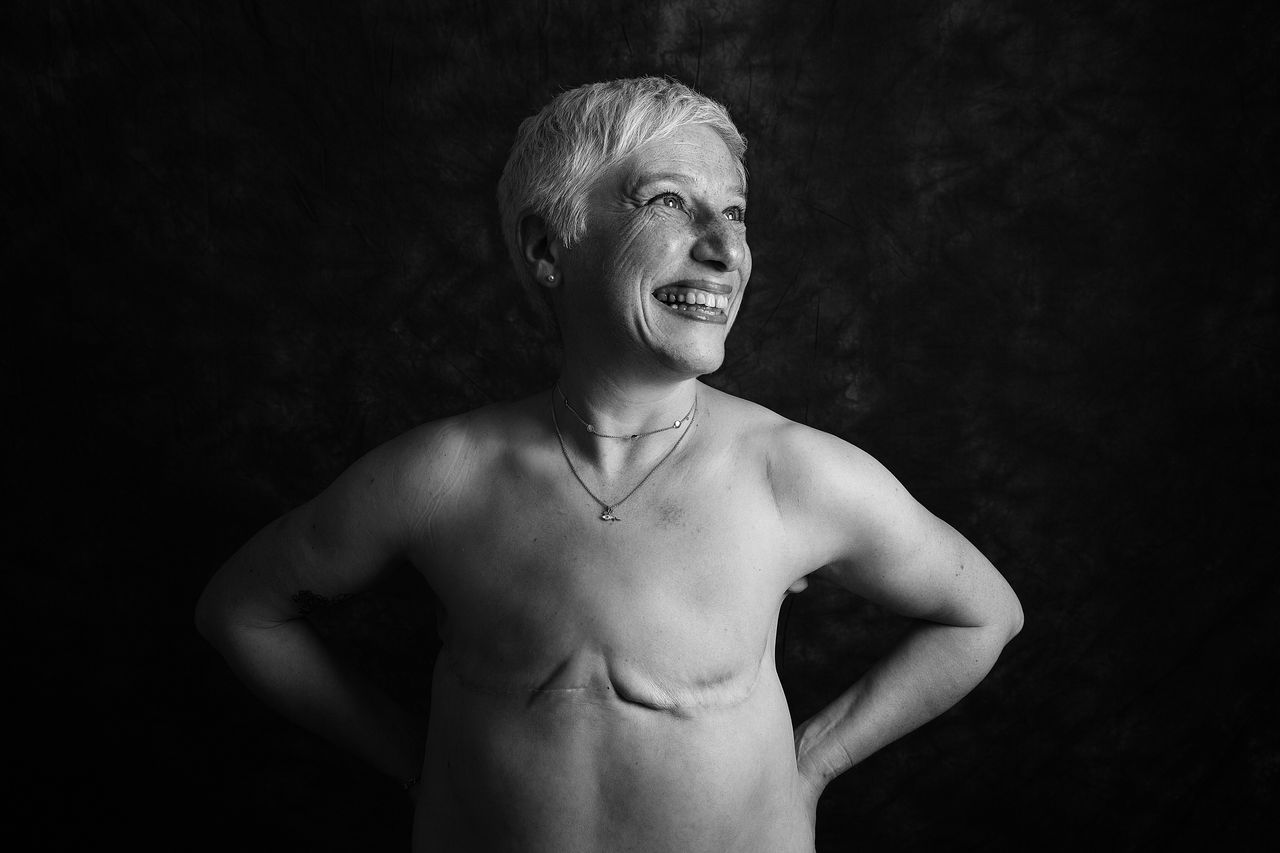 Η 57χρονη Τζούλιετ Φιτζπάτρικ, 57 ετών, διαγνώστηκε με καρκίνο του μαστού το 2016