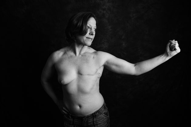 Thomasina McGuigan, 45, from Portsmouth, was diagnosed at 20 with stage 3 invasive breast cancer.