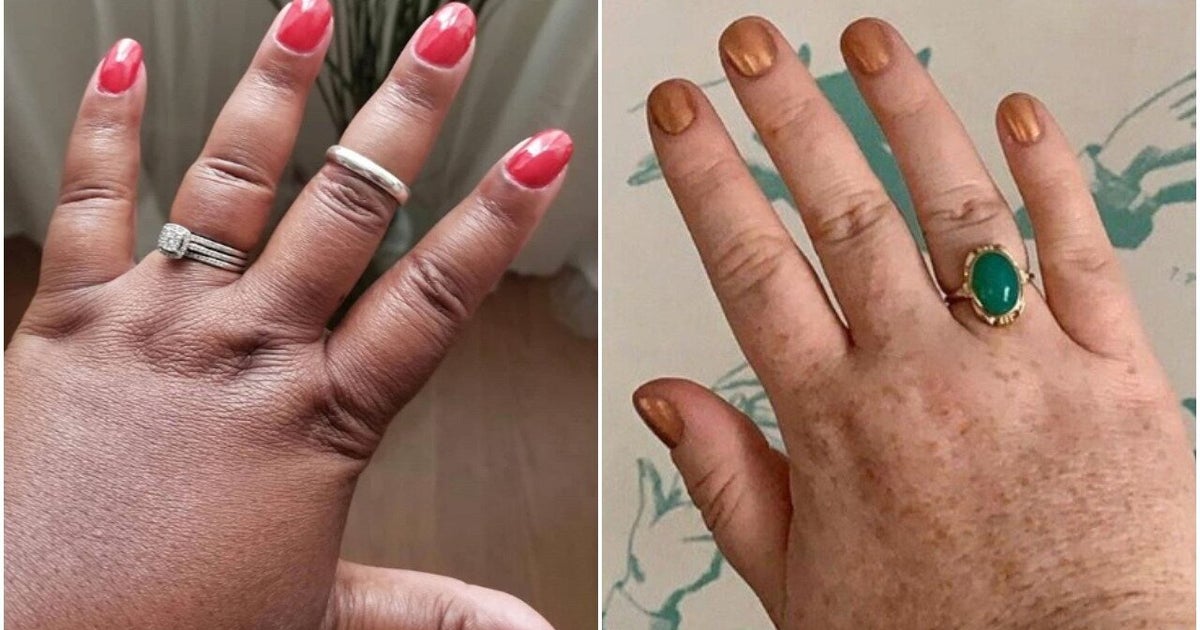 Chubby Fingers Are Getting Their Due Thanks To Social Media