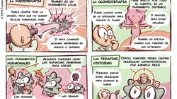¿Cómo se trata el cáncer de