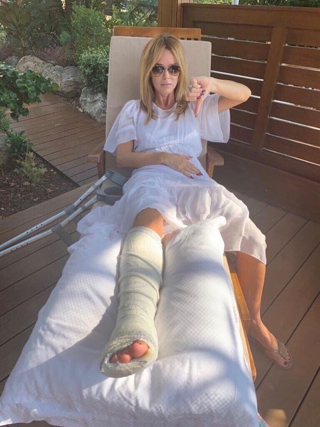 Amanda Holden Rushed To Hospital After Breaking Leg During ‘Nasty’ Inflatable Assault Course Accident