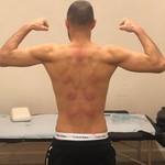 Ces taches rouges sur le dos de Karim Benzema sont des traces de