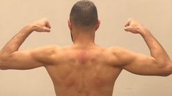 Ces taches rouges sur le dos de Karim Benzema sont des traces de