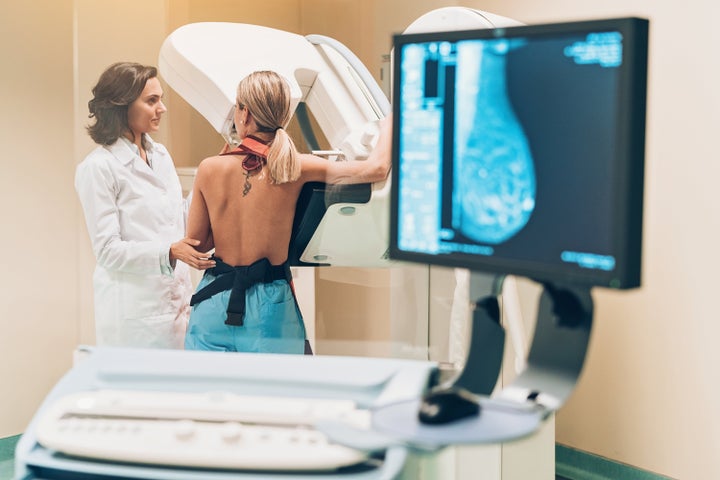 Most young people have dense breast tissue that prevents mammograms from being effective.