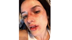 Bella Thorne accusée de banaliser les violences conjugales avec ce maquillage