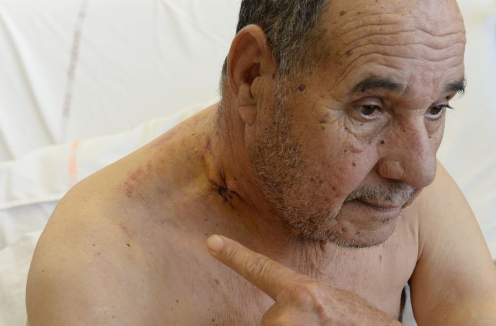Amar Kariouh, 78, on Wednesday showed the bullet hole to his neck as he recuperates at a hospital in France after he was wounded on Oct. 28 in an attack at a mosque.