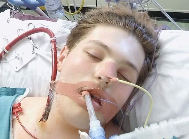 British Teenager Almost Died From Lung Failure After Vaping