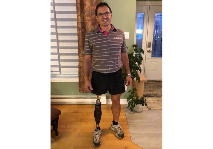 Richard Boily a été le premier patient au Québec à subir une chirurgie d'ostéointégration.