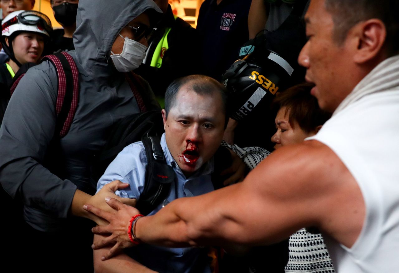 A man bleeds after being beaten by anti-government demonstrators during a protest.