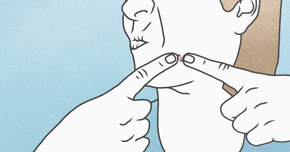 How To Treat A Deep Zit As Soon As You Spot It | HuffPost Life