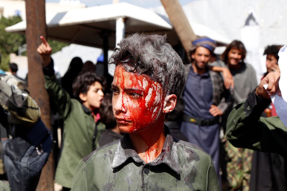 Ενα αγόρι, στέκεται μπροστά στα γραφεία των Ηνωμένων Εθνών, στην πόλη Σαναά, με το πρόσωπο του καλυμμένο με ψεύτικο αίμα, κατά την διαμαρτυρία, που πραγματοποιήθηκε, την Παγκόσμια Ημέρα του Παιδιού, την Τετάρτη, 20 Νοεμβρίου, δείχνοντας έτσι την αντίθεση του στον πόλεμο που γίνεται στην Υεμένη.