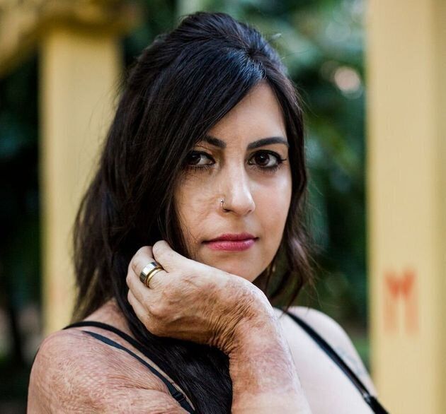 Há seis anos, Bárbara sobreviveu a uma tentativa de feminicídio em Porto Alegre