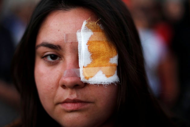 A protester wears an eyepatch in support of Gustavo Gatica in his hometown La Colina, Chile November 10, 2019, after Gatica was hit by pellets in his eyes on Friday during a protest against Chile's government in Santiago. REUTERS/Jorge Silva     TPX IMAGES OF THE DAY