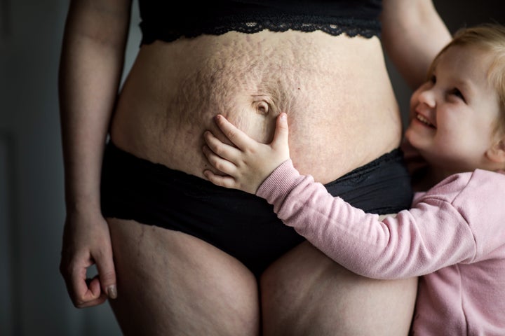 Raw Photos Celebrate The Beautiful Messiness Of Postpartum Life