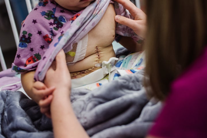 Abby at Children's Hospital of Philadelphia for her liver transplant.