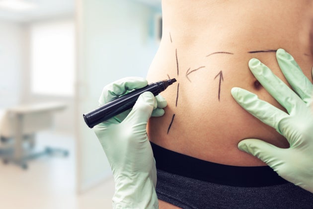 I Thought Traveling To Colombia For Plastic Surgery Would Make Me Happy Here S What Happened Instead Huffpost
