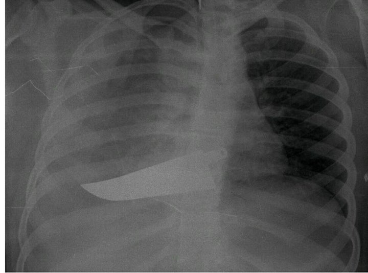 An X-ray from the “Invisibility Is Not A Superpower" exhibit. 