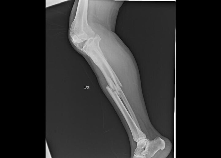 “Invisibility Is Not A Superpower” was unveiled on the International Day for the Elimination of Violence Against Women.