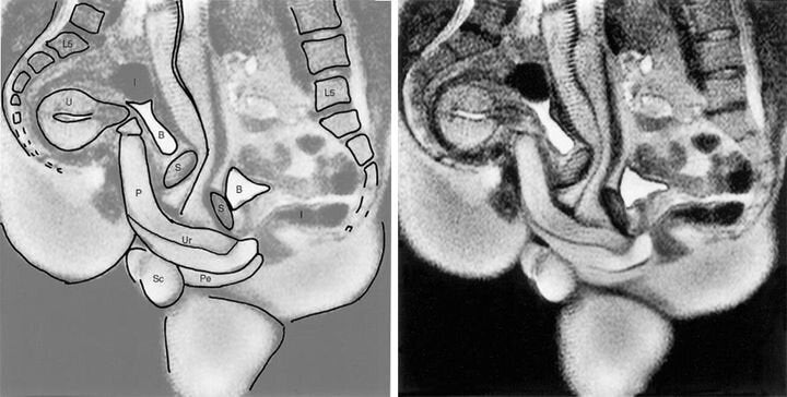 MRI 이미지