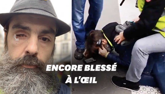 Jérôme Rodrigues a reçu “un coup de bouclier au niveau de l’œil” à la manif