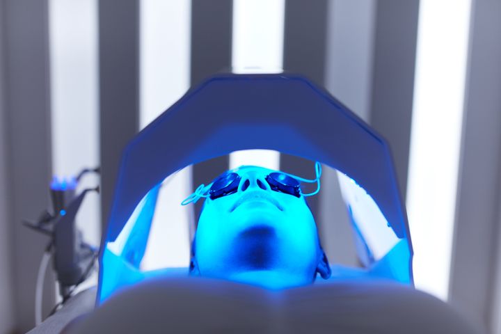 <a href="https://www.huffpost.com/entry/are-at-home-light-therapy-treatment-for-acne-worth-it_n_5963efc4e4b005b0fdc7ab8f" target="_blank" role="link" class=" js-entry-link cet-internal-link" data-vars-item-name="Blue light therapy" data-vars-item-type="text" data-vars-unit-name="5e0e4751e4b0b2520d1eb0b1" data-vars-unit-type="buzz_body" data-vars-target-content-id="https://www.huffpost.com/entry/are-at-home-light-therapy-treatment-for-acne-worth-it_n_5963efc4e4b005b0fdc7ab8f" data-vars-target-content-type="buzz" data-vars-type="web_internal_link" data-vars-subunit-name="article_body" data-vars-subunit-type="component" data-vars-position-in-subunit="5">Blue light therapy</a> can help to kill acne-causing bacteria on the skin's surface.
