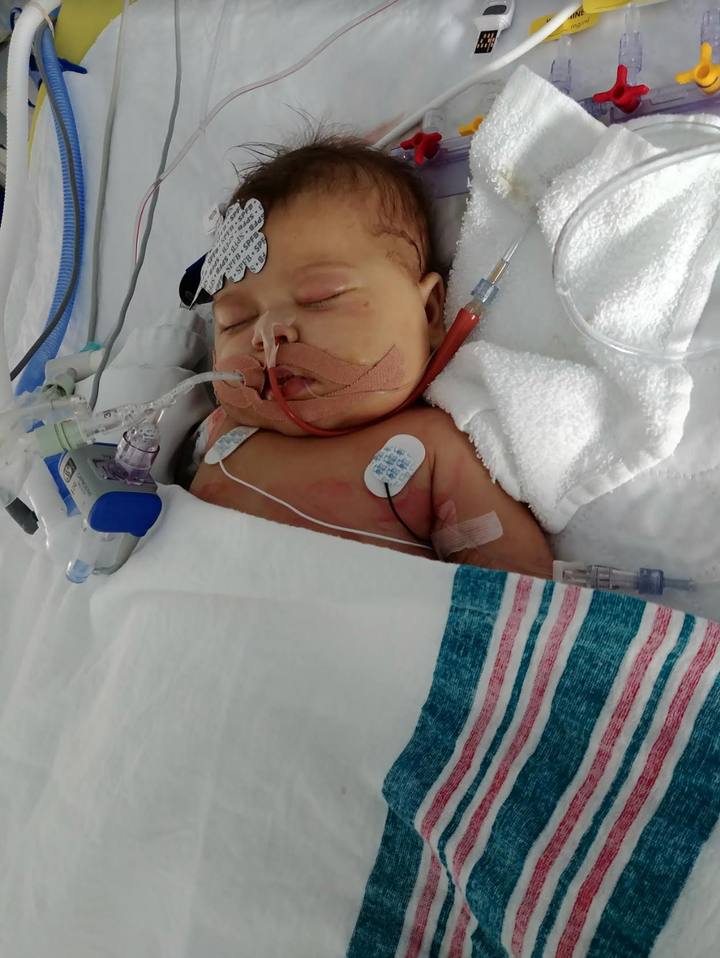 A 5 Mois Ce Bebe Est Sauve In Extremis Par Une Greffe Du Foie De Son Papa Huffpost Null A 5 Mois Ce Bebe Est Sauve In Extremis Par Une Greffe Du Foie De Son Papa Huffpost Null
