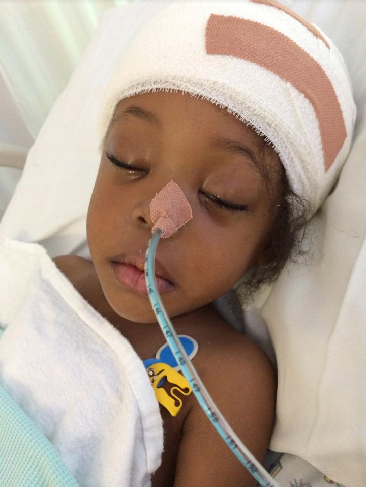 Kaityln Davis at the age of three after eight hours of surgery to remove a brain tumour
