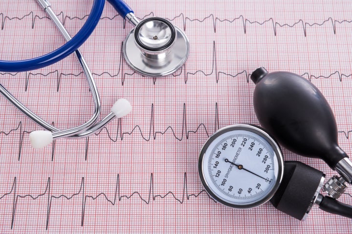 Sphygmomanometer with aneroid gauge and stethoscope with Electrocardiogram paper, still life photo.