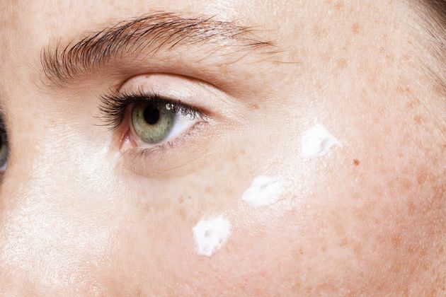 What Causes Dark Circles And How Do You Get Rid Of Them?