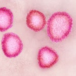 新型肺炎とは？