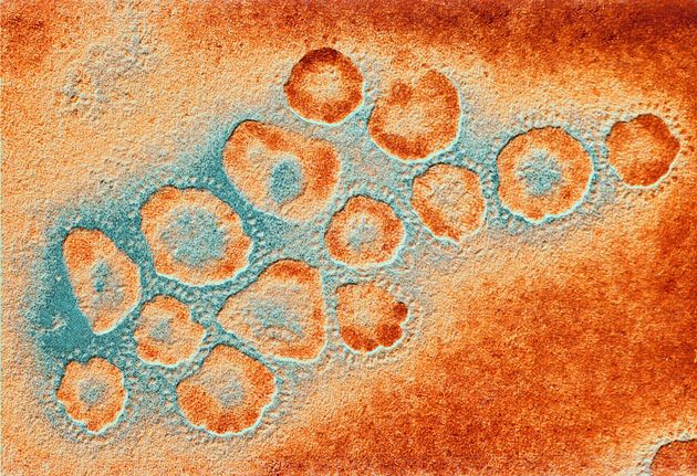 Coronavirus In China – Heres Everything You Need To Know