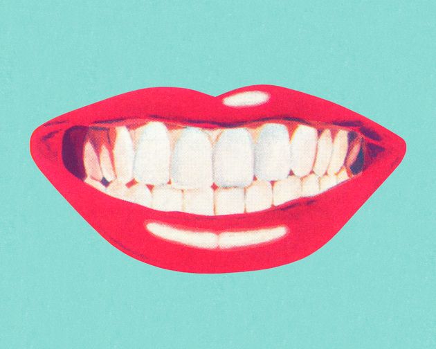 Thinking About Getting Veneers? Heres What You Need To Know