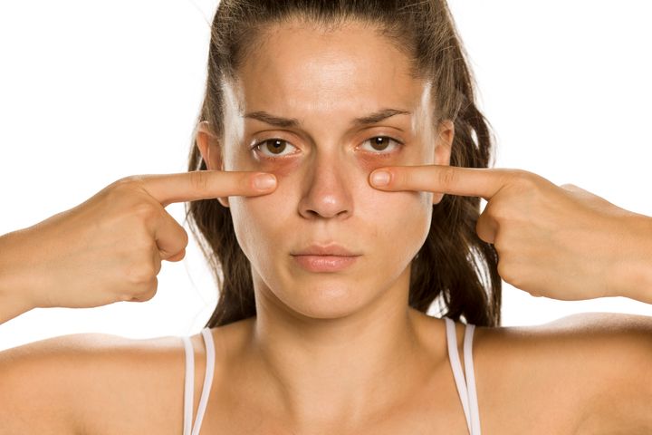 Young woman touching her low eyelids on yellow background