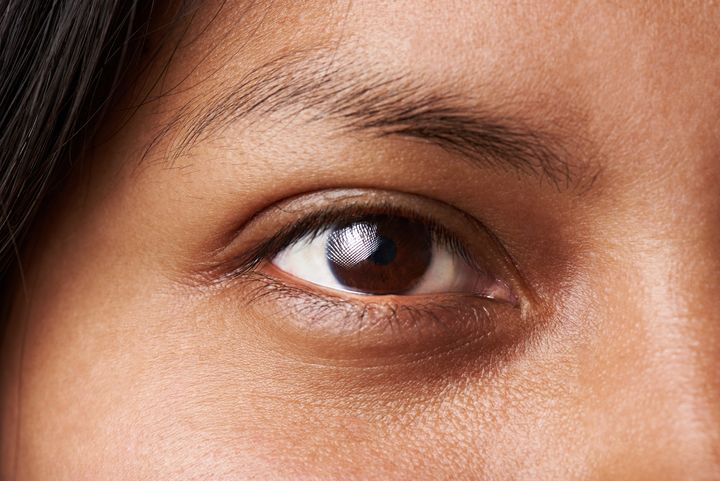 Οι μελαχρινοί άνθρωποι έχουν πιο σκούρα επιδερμίδα κάτω από τα μάτια. 