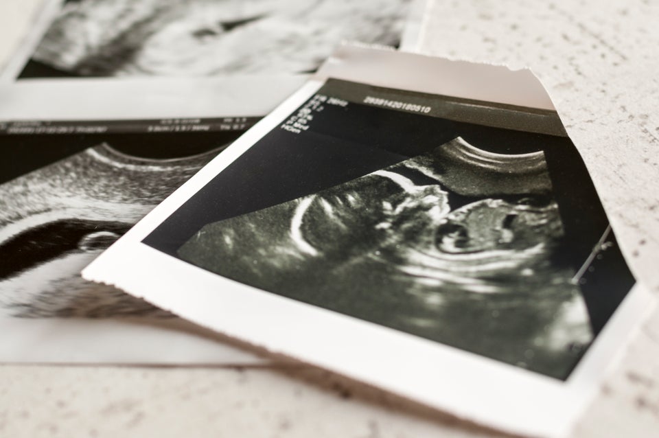 Photographs of ultrasound of pregnancy at 4 weeks and 20 weeks of pregnancy Selective focus.