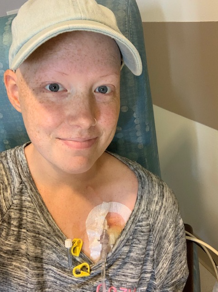 Plum receiving chemotherapy in 2019.