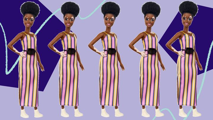 Barbie just dropped its latest line of inclusive dolls, and the doll with vitiligo is already available. 