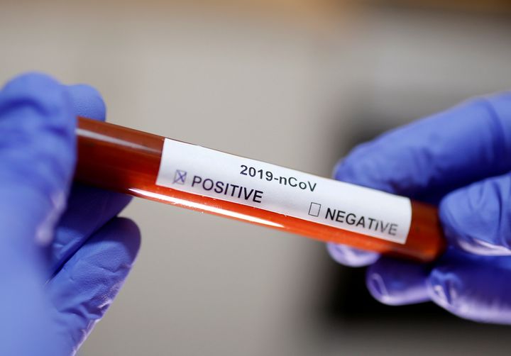 コロナウイルス名ラベル付きの試験管（2020年1月29日）