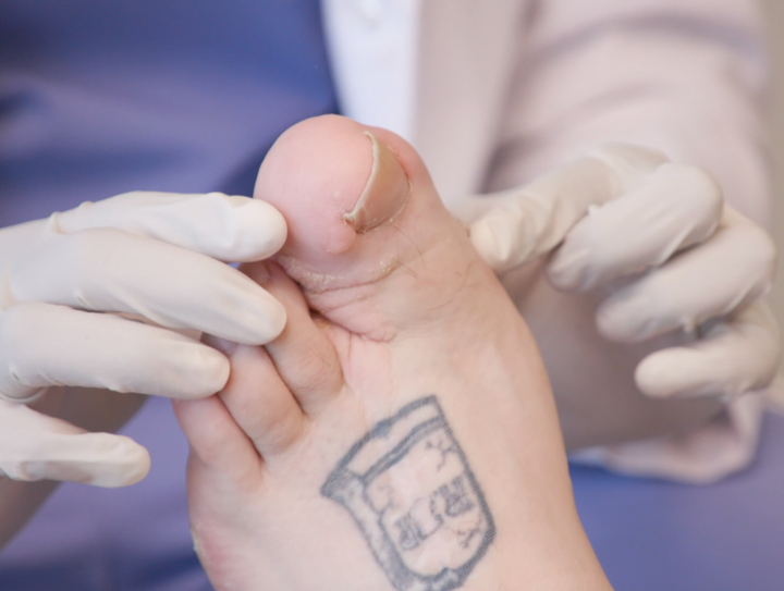 A man shows off his really big big toe in a clip from the TLC series "My Feet Are Killing Me."