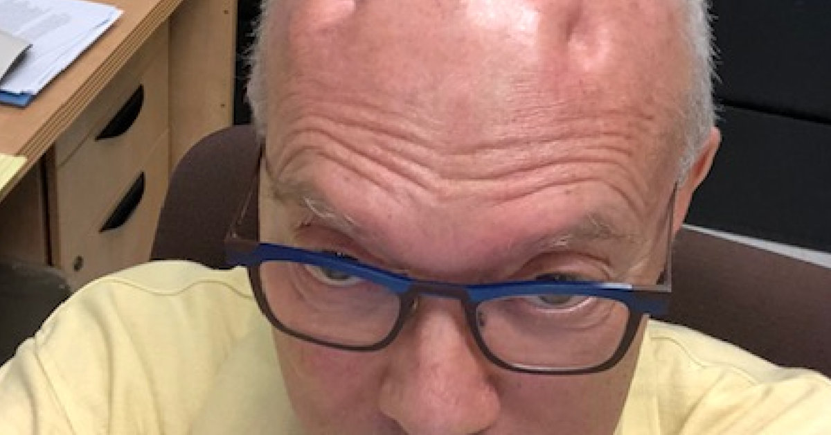 I Suddenly Have 4 Severe Dents In My Head And I m Trying To Accept My New Appearance HuffPost HuffPost Personal