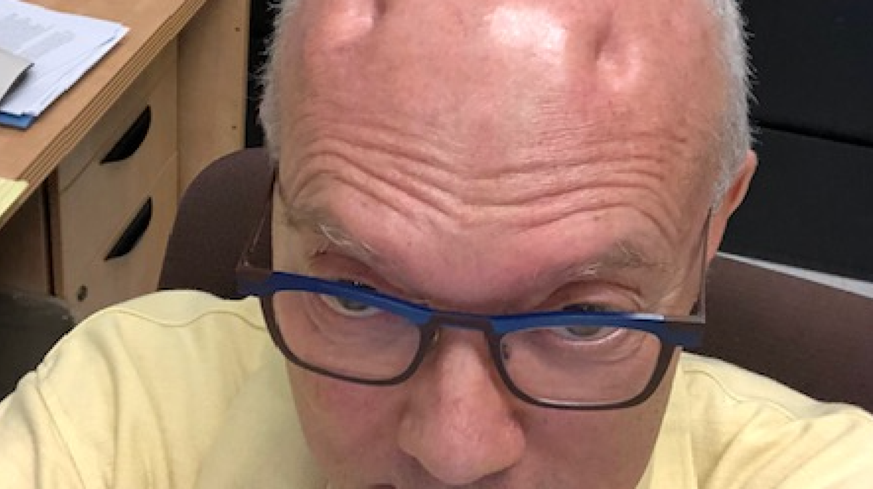 What Does Dents In Your Head Mean at Loren Bona blog