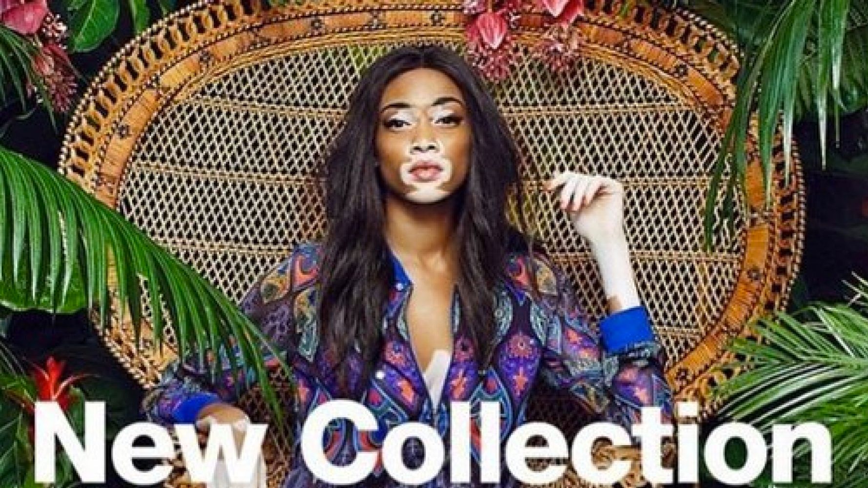 venster schrobben Het beste Model With Vitiligo, Winnie Harlow, Stars In Desigual And Diesel Fashion  Campaigns | HuffPost UK News