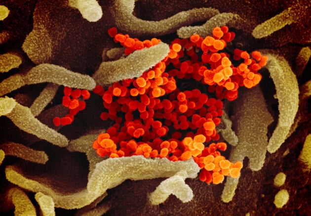 This undated electron microscope image made available by the U.S. National Institutes of Health shows...