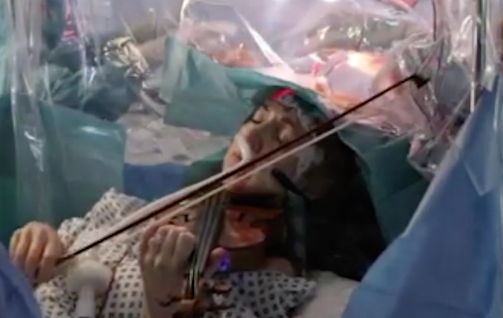 Dagmar Turner plays the violin while British doctors remove a brain tumor. 