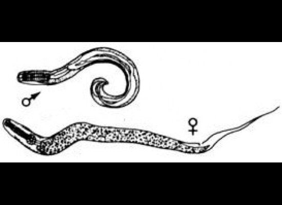 Fact Attack: Worms invading your ass! 