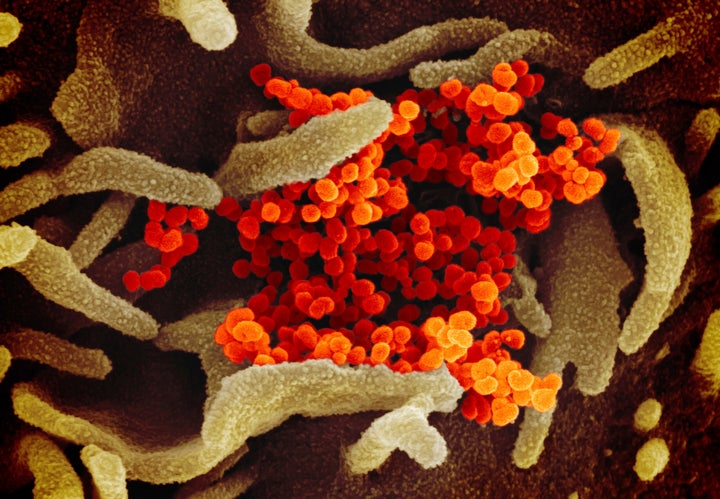 The Novel Coronavirus SARS-CoV-2, orange, emerging from the surface of cells, green, in a lab. There is no immediate threat o